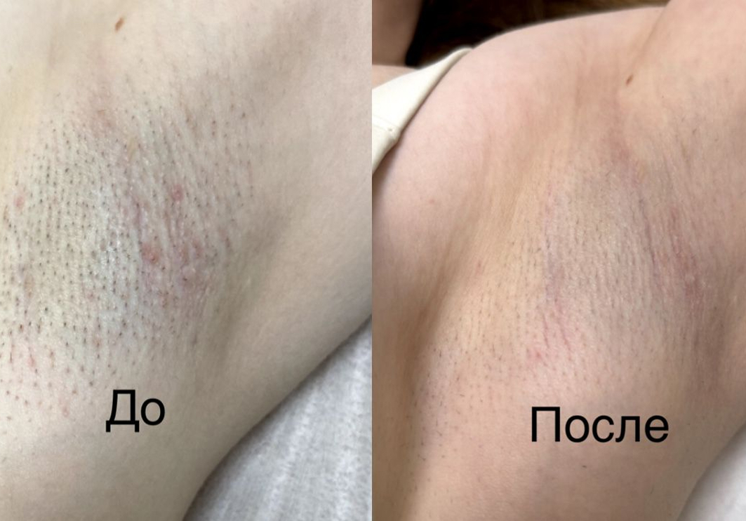 Пример работы
